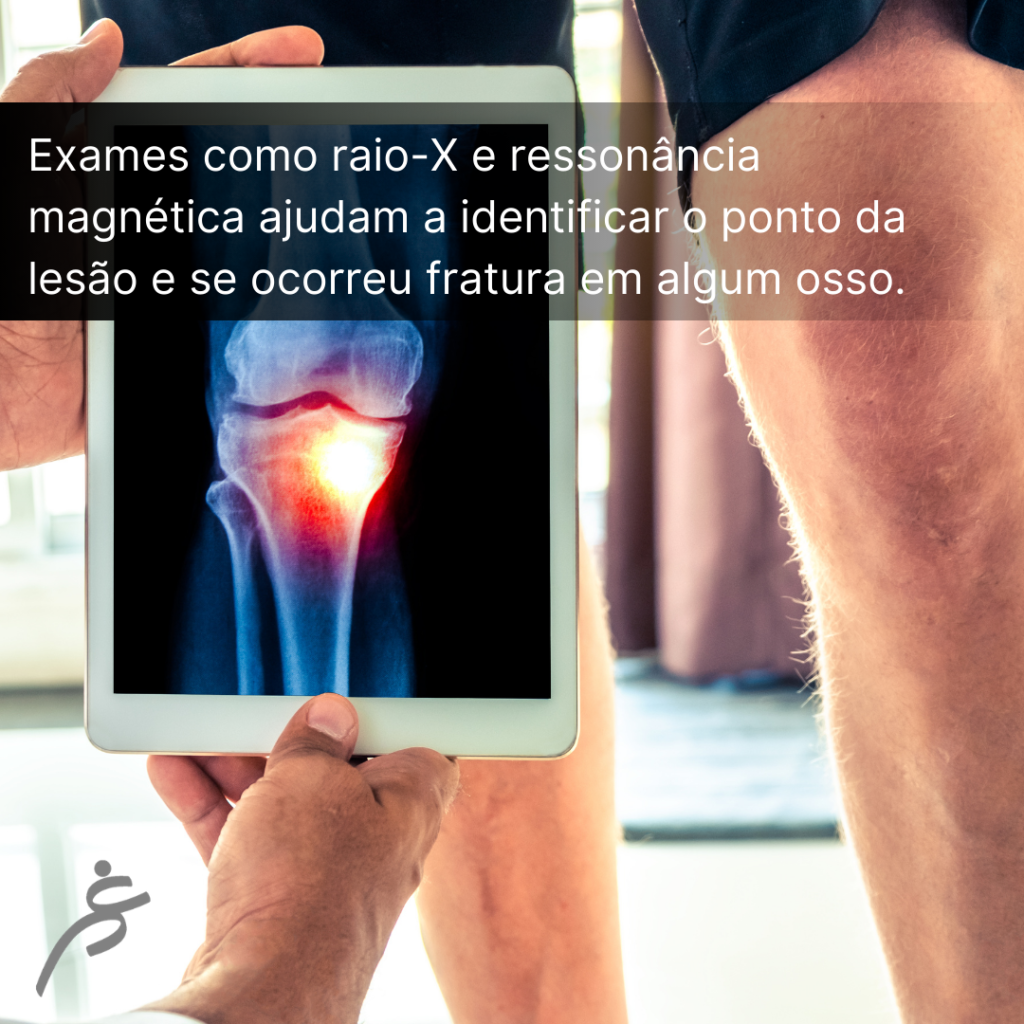 Lesão do Ligamento Colateral Medial Dr Paulo Cavalcante