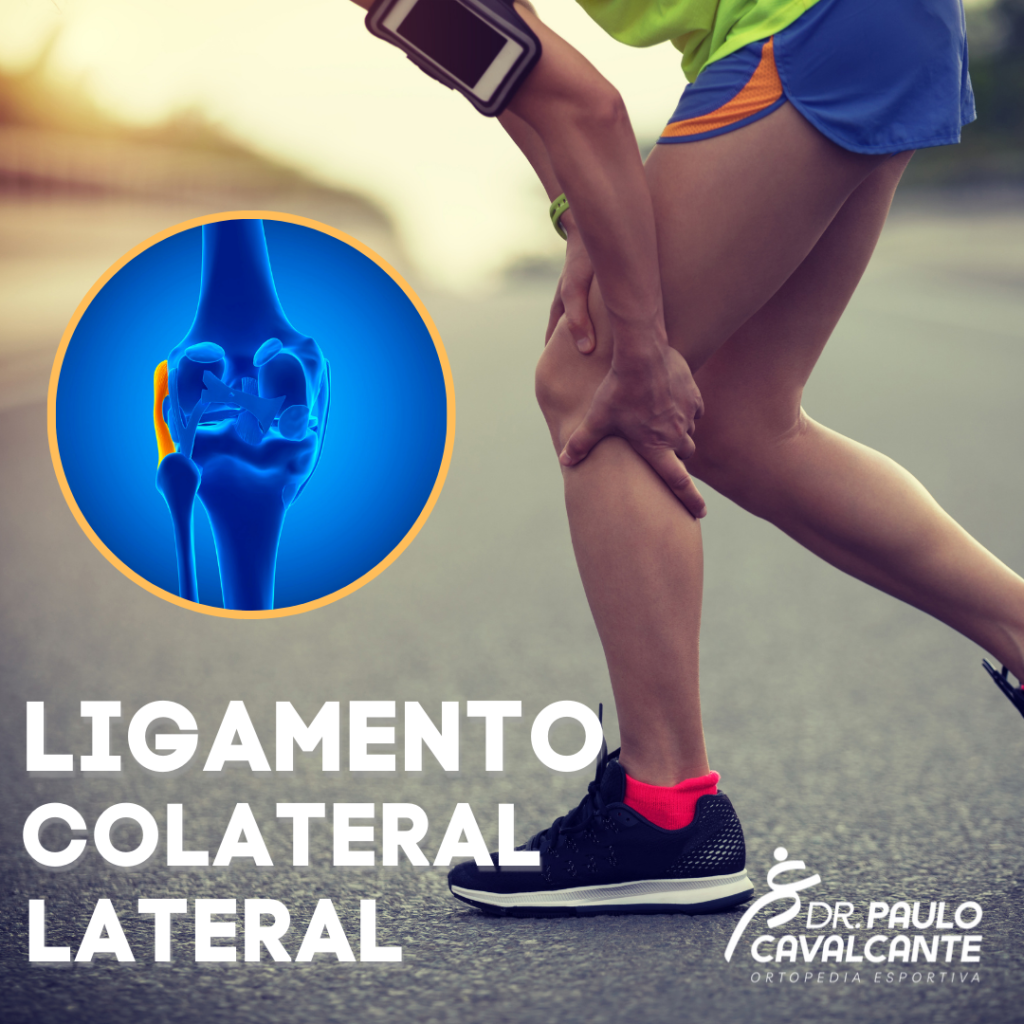 lesão do ligamento colateral lateral dr paulo cavalcante